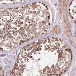 DGUOK Antibody in Immunohistochemistry (Paraffin) (IHC (P))