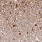 Adenylate Kinase 5 Antibody in Immunohistochemistry (Paraffin) (IHC (P))