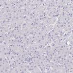 Adenylate Kinase 5 Antibody in Immunohistochemistry (IHC)