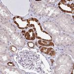 RBM18 Antibody in Immunohistochemistry (Paraffin) (IHC (P))