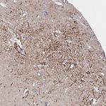 SLC30A6 Antibody in Immunohistochemistry (Paraffin) (IHC (P))