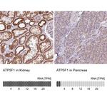 ATP Synthase B1 Antibody in Immunohistochemistry (IHC)