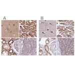 ATP Synthase B1 Antibody in Immunohistochemistry (IHC)