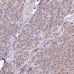 ATP Synthase B1 Antibody in Immunohistochemistry (IHC)