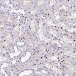 WDR72 Antibody in Immunohistochemistry (IHC)