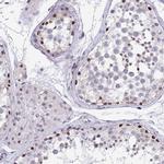 WDR72 Antibody in Immunohistochemistry (IHC)