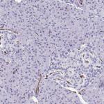 SLC35B1 Antibody in Immunohistochemistry (Paraffin) (IHC (P))