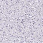 HOXB4 Antibody in Immunohistochemistry (Paraffin) (IHC (P))