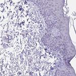 HOXB4 Antibody in Immunohistochemistry (Paraffin) (IHC (P))