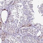 HOXB4 Antibody in Immunohistochemistry (Paraffin) (IHC (P))