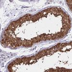 ADAMTSL1 Antibody in Immunohistochemistry (Paraffin) (IHC (P))