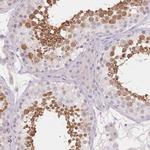 SUV39H2 Antibody in Immunohistochemistry (Paraffin) (IHC (P))