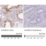 SUV39H2 Antibody in Immunohistochemistry (IHC)