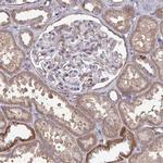 ISCU Antibody in Immunohistochemistry (IHC)