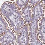 VPS4B Antibody in Immunohistochemistry (Paraffin) (IHC (P))