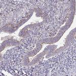 VPS4B Antibody in Immunohistochemistry (Paraffin) (IHC (P))