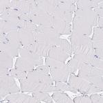 VPS4B Antibody in Immunohistochemistry (Paraffin) (IHC (P))