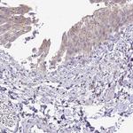 VPS4B Antibody in Immunohistochemistry (Paraffin) (IHC (P))