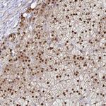 ACD Antibody in Immunohistochemistry (Paraffin) (IHC (P))