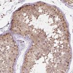 NUDT10 Antibody in Immunohistochemistry (Paraffin) (IHC (P))