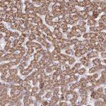 ACSM2A Antibody in Immunohistochemistry (Paraffin) (IHC (P))