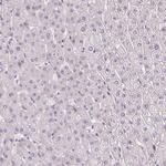 CYP11B2 Antibody in Immunohistochemistry (Paraffin) (IHC (P))