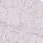 CYP11B2 Antibody in Immunohistochemistry (IHC)