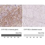 CYP11B2 Antibody