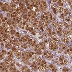 CYP11B2 Antibody in Immunohistochemistry (IHC)