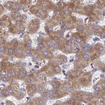 RPS15 Antibody in Immunohistochemistry (IHC)