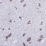 RPS15 Antibody in Immunohistochemistry (IHC)