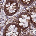 RPS15 Antibody in Immunohistochemistry (IHC)