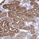 RASL11B Antibody in Immunohistochemistry (Paraffin) (IHC (P))