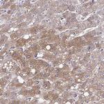 RASL11B Antibody in Immunohistochemistry (Paraffin) (IHC (P))