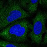 NAA30 Antibody in Immunocytochemistry (ICC/IF)