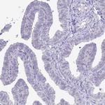 NAA30 Antibody in Immunohistochemistry (Paraffin) (IHC (P))