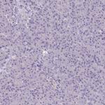 NAA30 Antibody in Immunohistochemistry (Paraffin) (IHC (P))