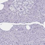 Granulysin Antibody in Immunohistochemistry (Paraffin) (IHC (P))