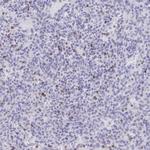 Granulysin Antibody in Immunohistochemistry (Paraffin) (IHC (P))