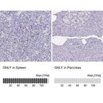 Granulysin Antibody