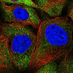 SEPN1 Antibody in Immunocytochemistry (ICC/IF)