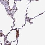 SEPN1 Antibody in Immunohistochemistry (Paraffin) (IHC (P))