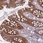 SLC26A2 Antibody in Immunohistochemistry (Paraffin) (IHC (P))