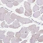 SLC26A2 Antibody in Immunohistochemistry (Paraffin) (IHC (P))