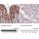 SLC26A2 Antibody in Immunohistochemistry (IHC)