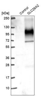 SLC26A2 Antibody in Western Blot (WB)