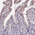 CEP63 Antibody in Immunohistochemistry (Paraffin) (IHC (P))