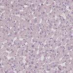 DNAH12 Antibody in Immunohistochemistry (Paraffin) (IHC (P))