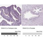 DNAH12 Antibody in Immunohistochemistry (IHC)