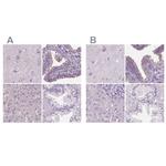 DNAH12 Antibody in Immunohistochemistry (IHC)